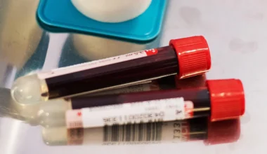 BilliontoOne yatırımı 48.5 milyon dolara ulaştı