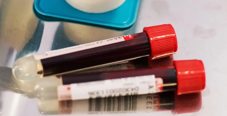 BilliontoOne yatırımı 48.5 milyon dolara ulaştı