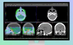 Apple Hastane İşine de El Attı