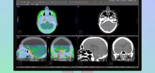 Apple Hastane İşine de El Attı