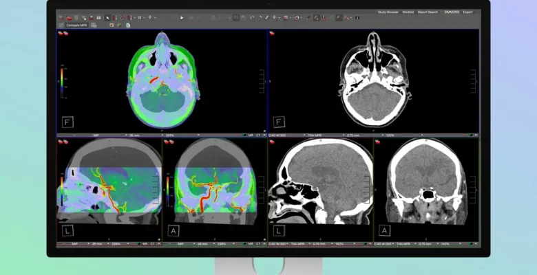Apple Hastane İşine de El Attı